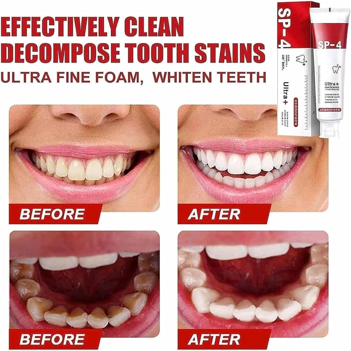 Yayashi Sp-4 Ultra Whitening Toothpaste Probiotic Stain