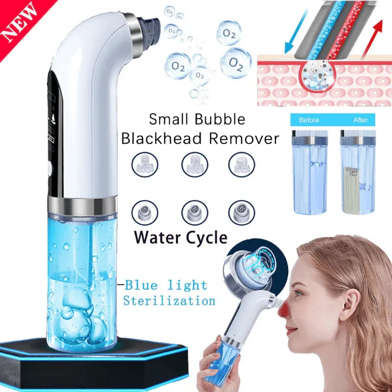 Bubble Facial & Blackhead Remover – Deep Cleanser for Acne, Pores