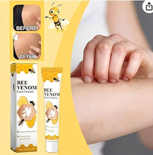 Fivfivgo Vitigo Bee Venom Correcting Cream 20g | Skin Tone Balancing